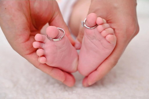 六安孕妇怎样预防妊娠纹